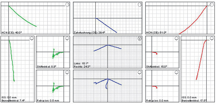 Arcus-digma-02.png#asset:49441