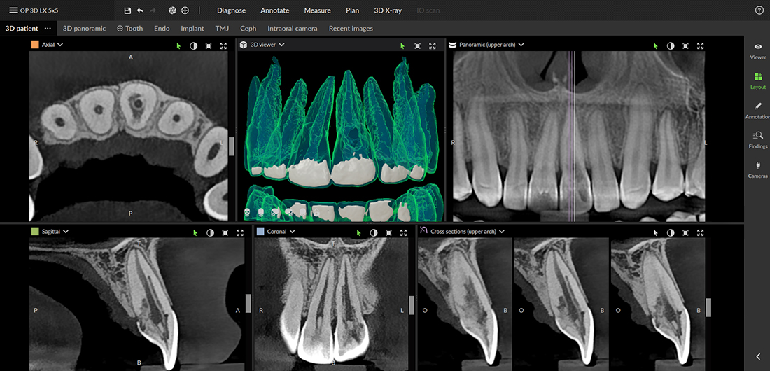 DEXIS Endodontia
