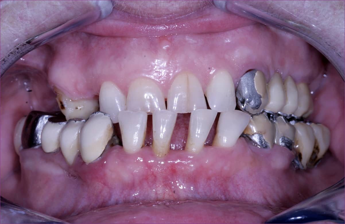 SB2-kiindulasi-interkuszpidacios-helyzet.JPG#asset:35735