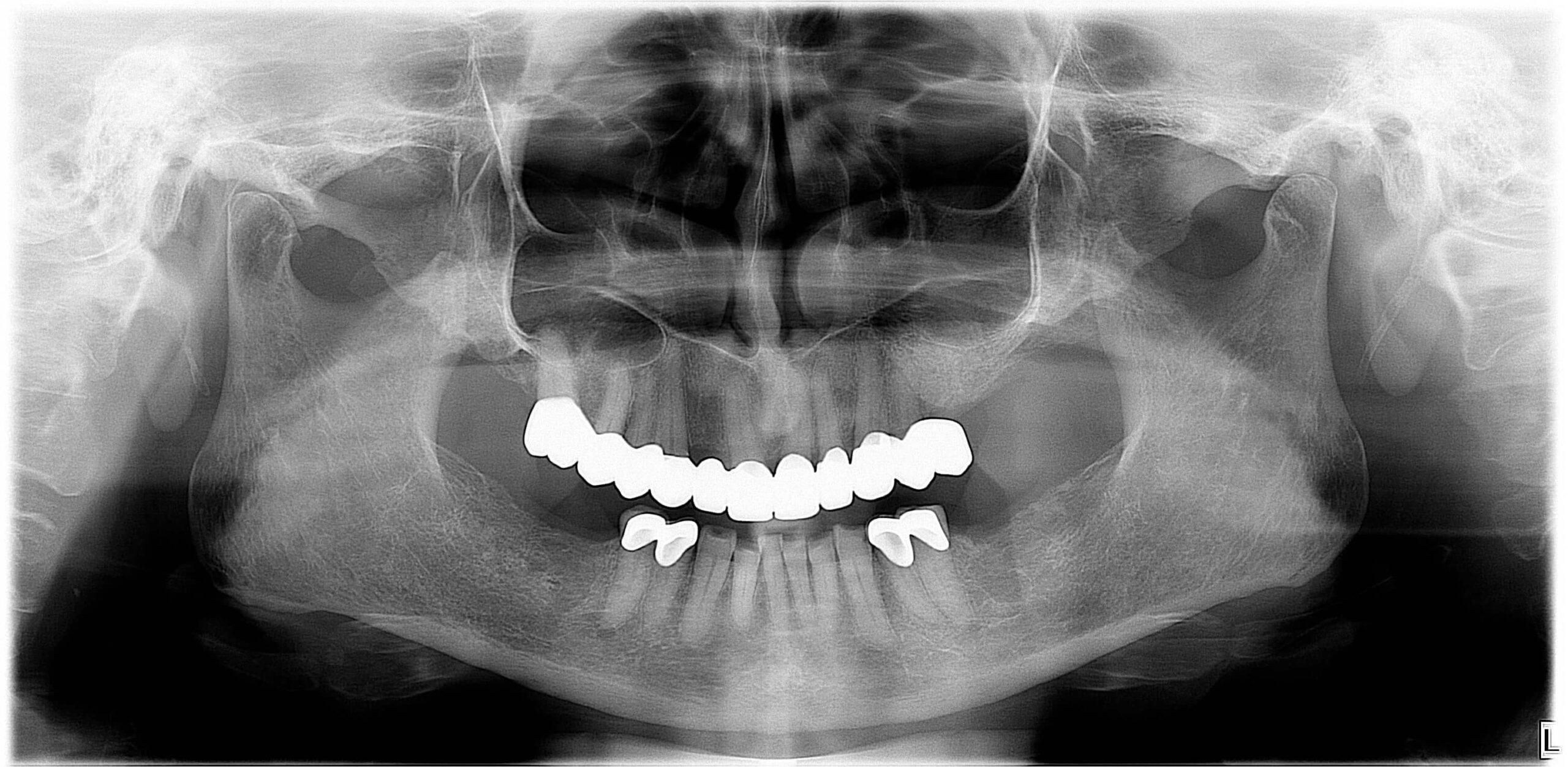 röntgen-1.jpg#asset:54134